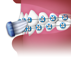 Brushing - Step 3